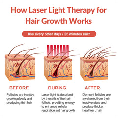 ZJZK Laser Cap - FDA Cleared Hair Laser Growth Treatment for Men & Women - Thinning Hair, Spot or Full Scalp, Denser/Fuller Hair, Medical Grade Laser